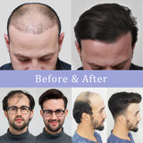Vlasy Mono Base Durable Men Toupee Natural 6'' Remy Human Hair Capillary Prosthesis Hair Replacement System For Men (Natural Black 1B#)